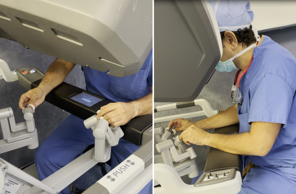 Two photos with different angles of a robotic surgery procedure.